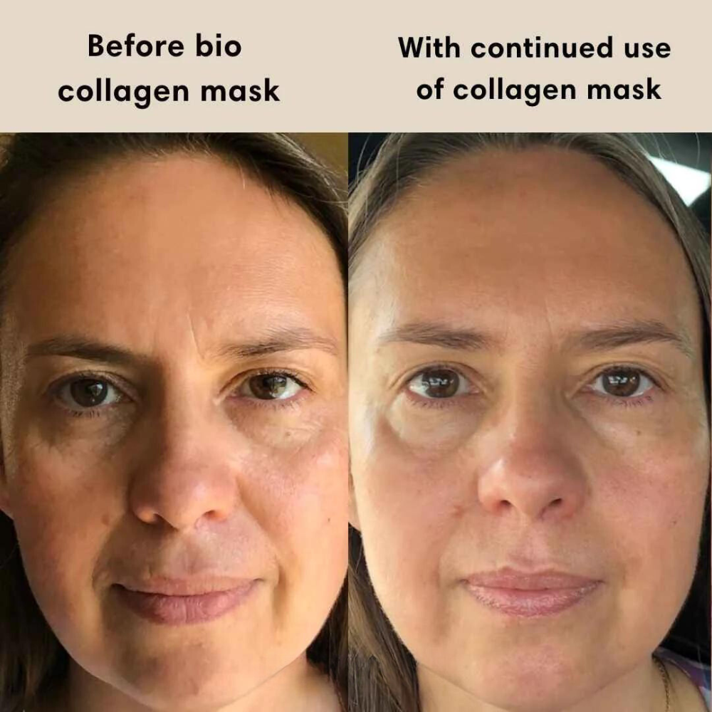 Radiant Skin™ Collagen Mask